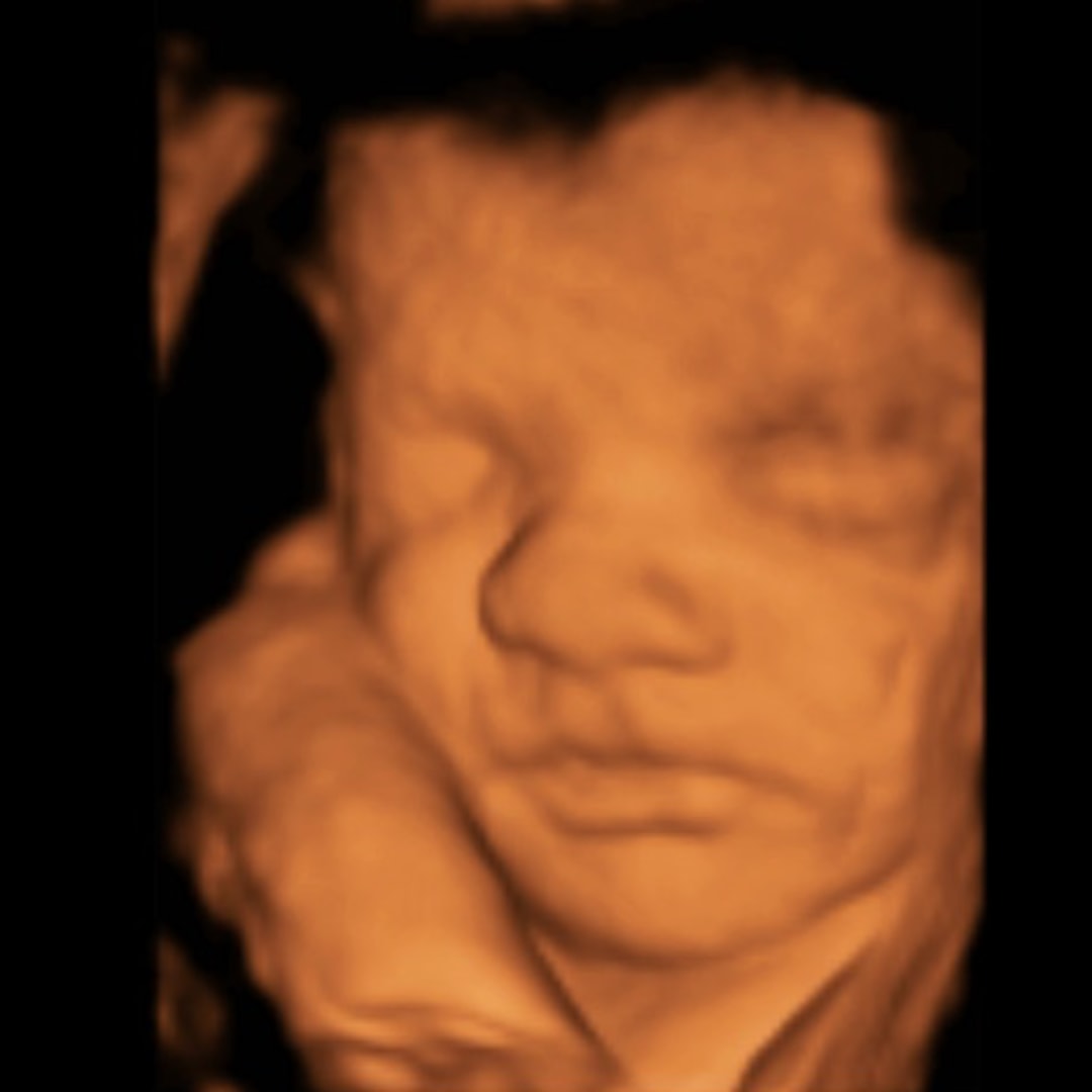 Photo shared by Brodie for their Babylist baby registry.