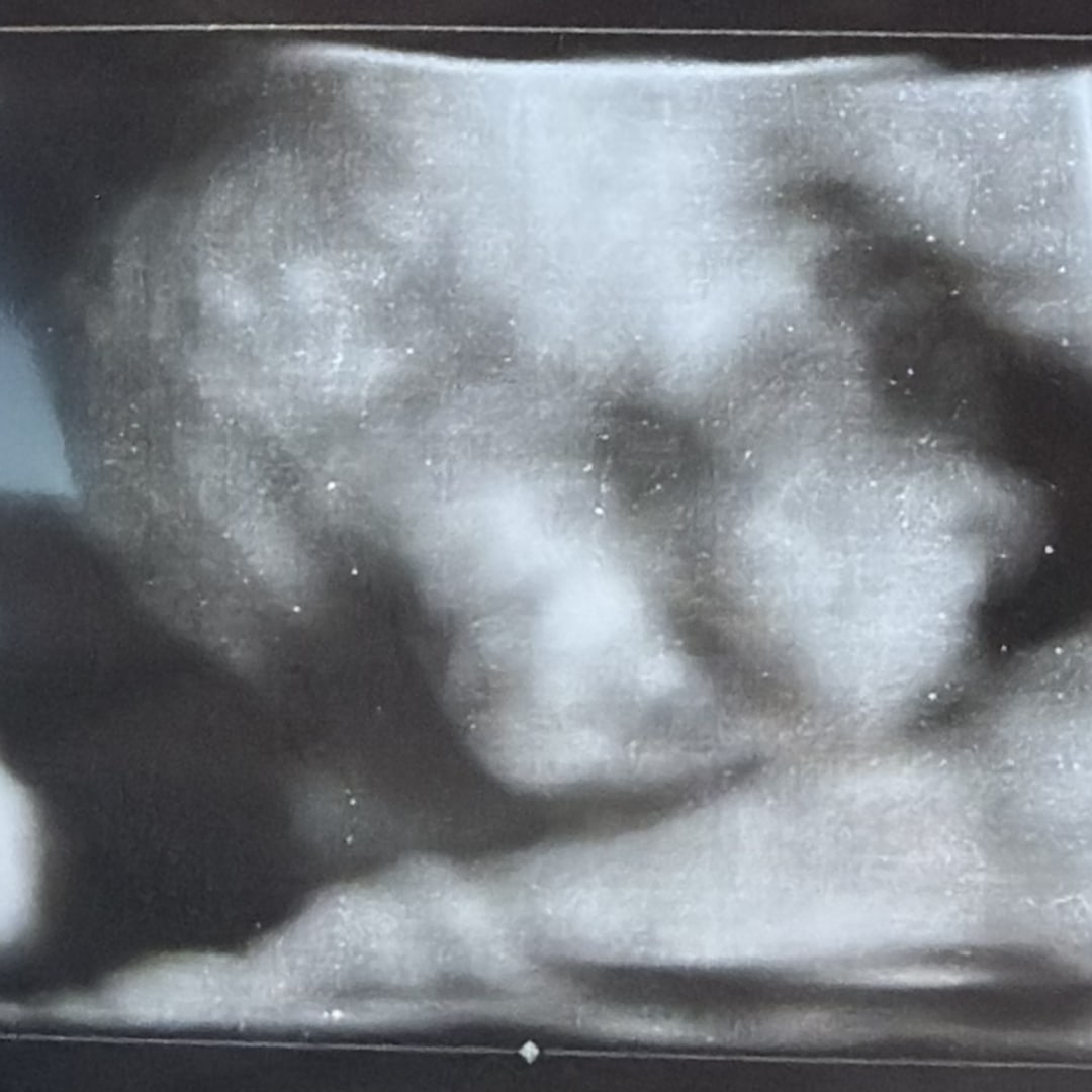 Photo shared by Jadeyn for their Babylist baby registry.