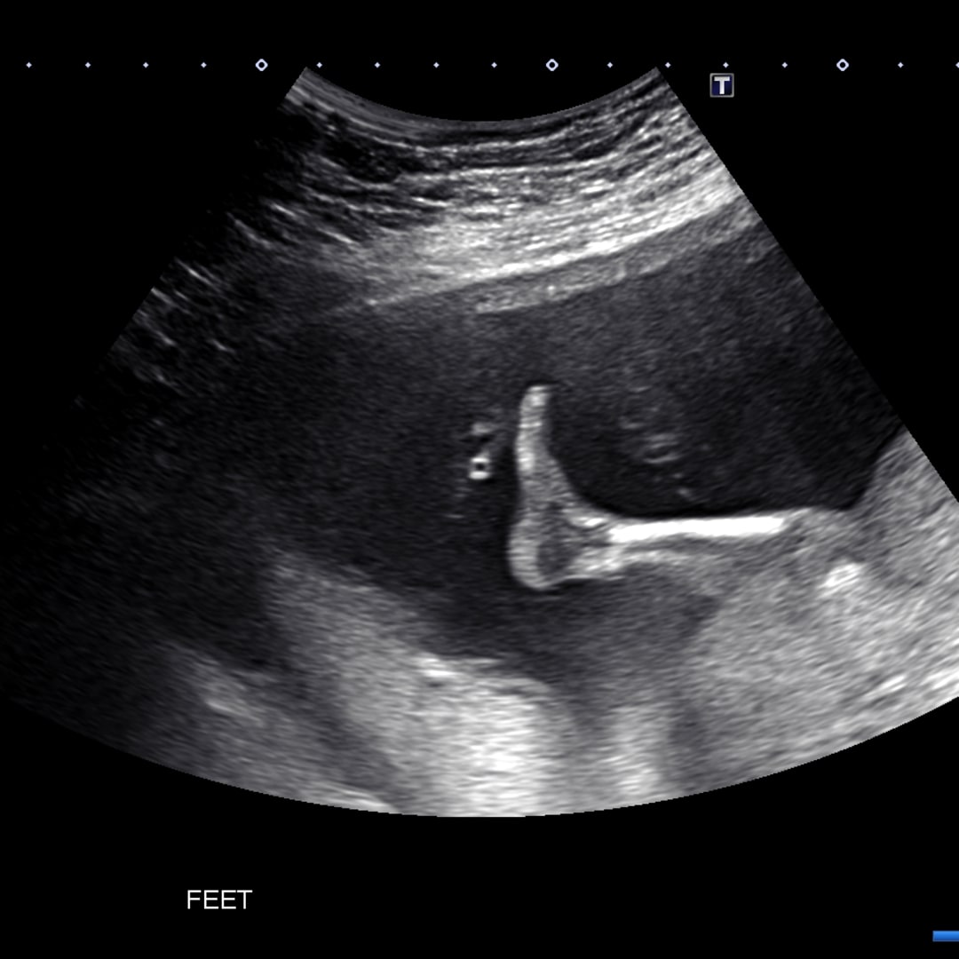 Photo shared by Shannan for their Babylist baby registry.
