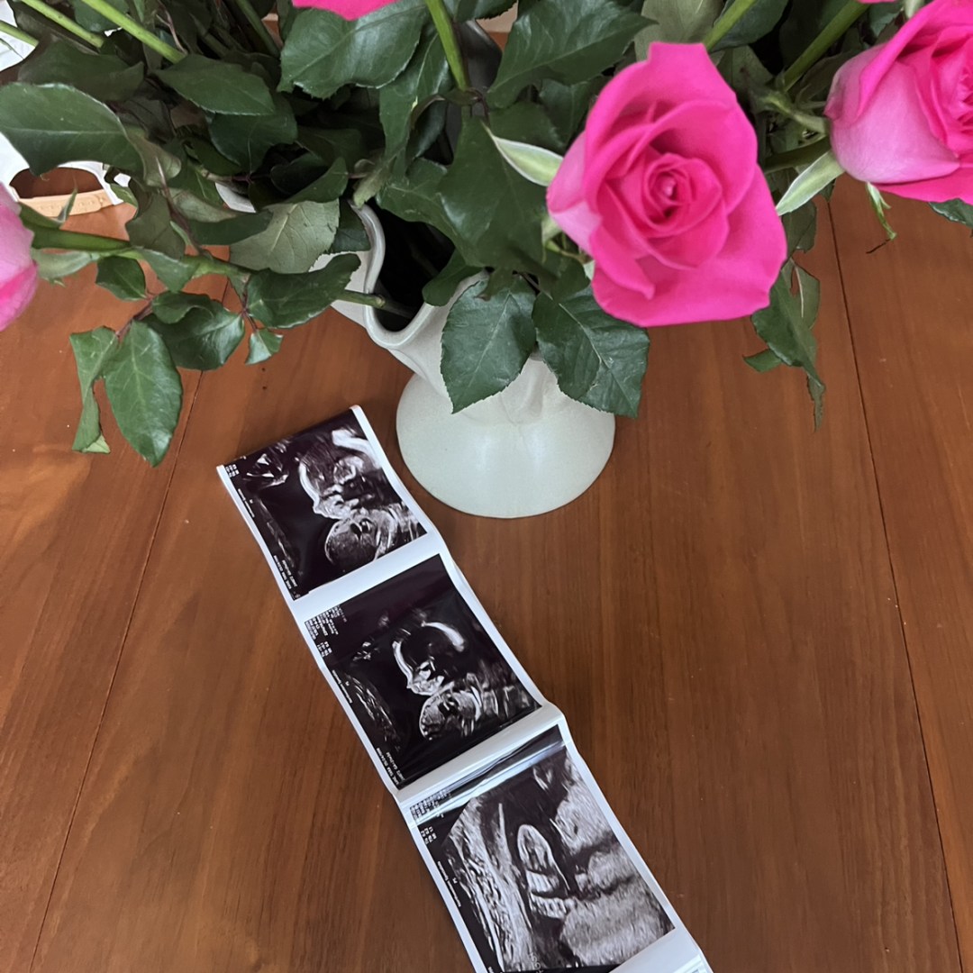 Photo shared by Tara for their Babylist baby registry.
