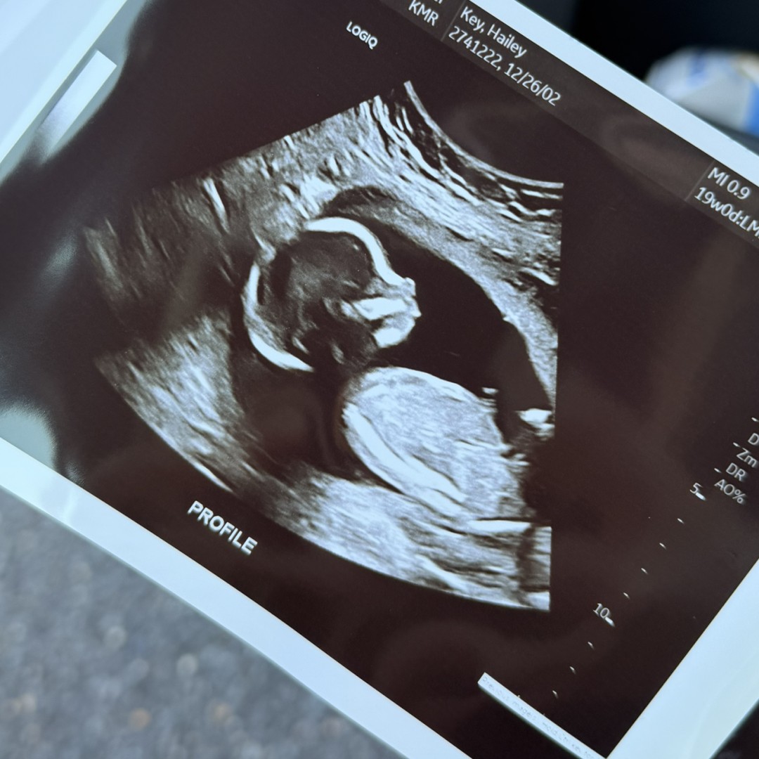 Photo shared by Hailey for their Babylist baby registry.