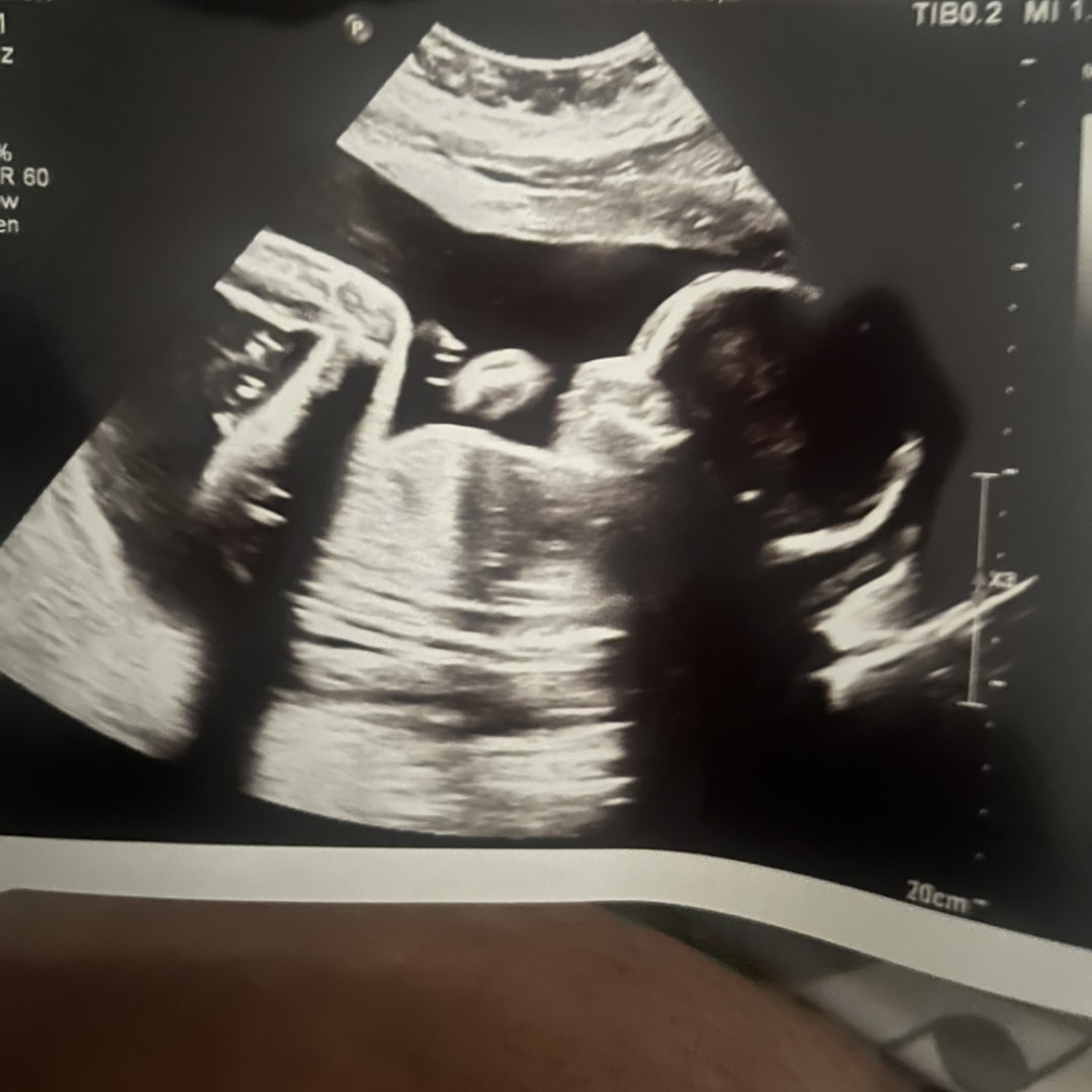 Photo shared by Danara for their Babylist baby registry.
