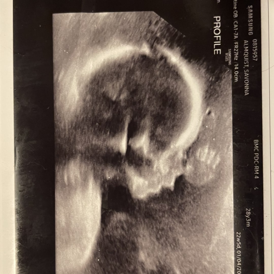 Photo shared by Savonna for their Babylist baby registry.