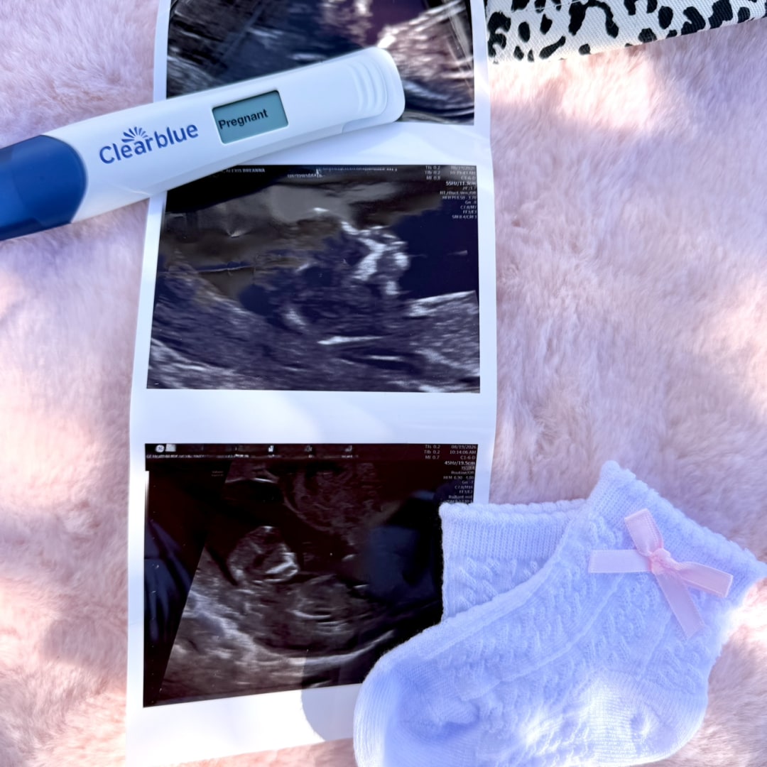 Photo shared by Alexis for their Babylist baby registry.