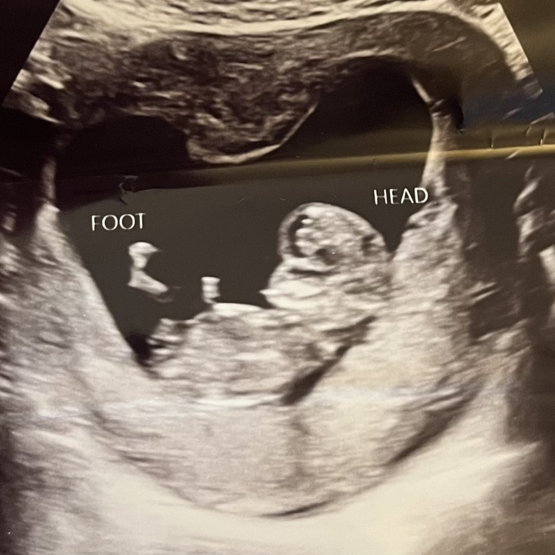 Photo shared by Emma for their Babylist baby registry.