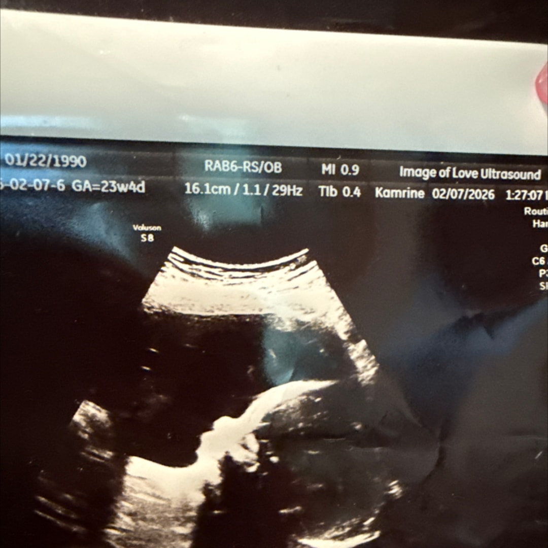 Photo shared by Cece for their Babylist baby registry.