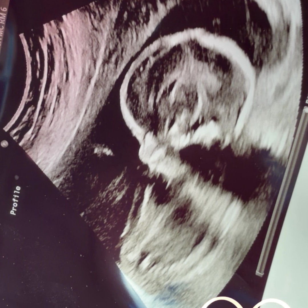 Photo shared by Alexandra for their Babylist baby registry.