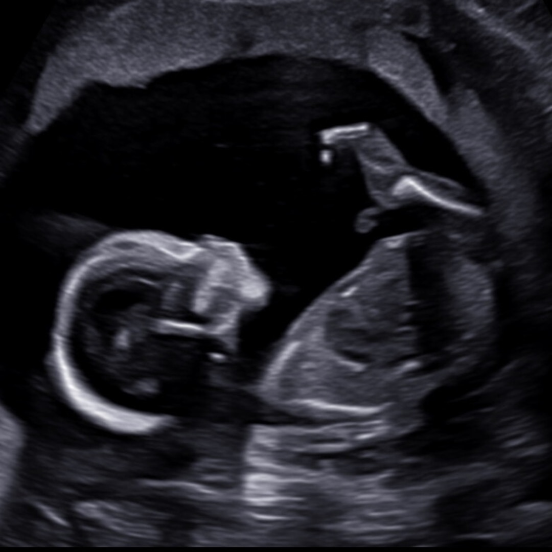 Photo shared by Jordan for their Babylist baby registry.