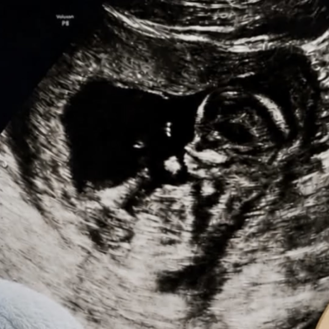 Photo shared by Jessica for their Babylist baby registry.
