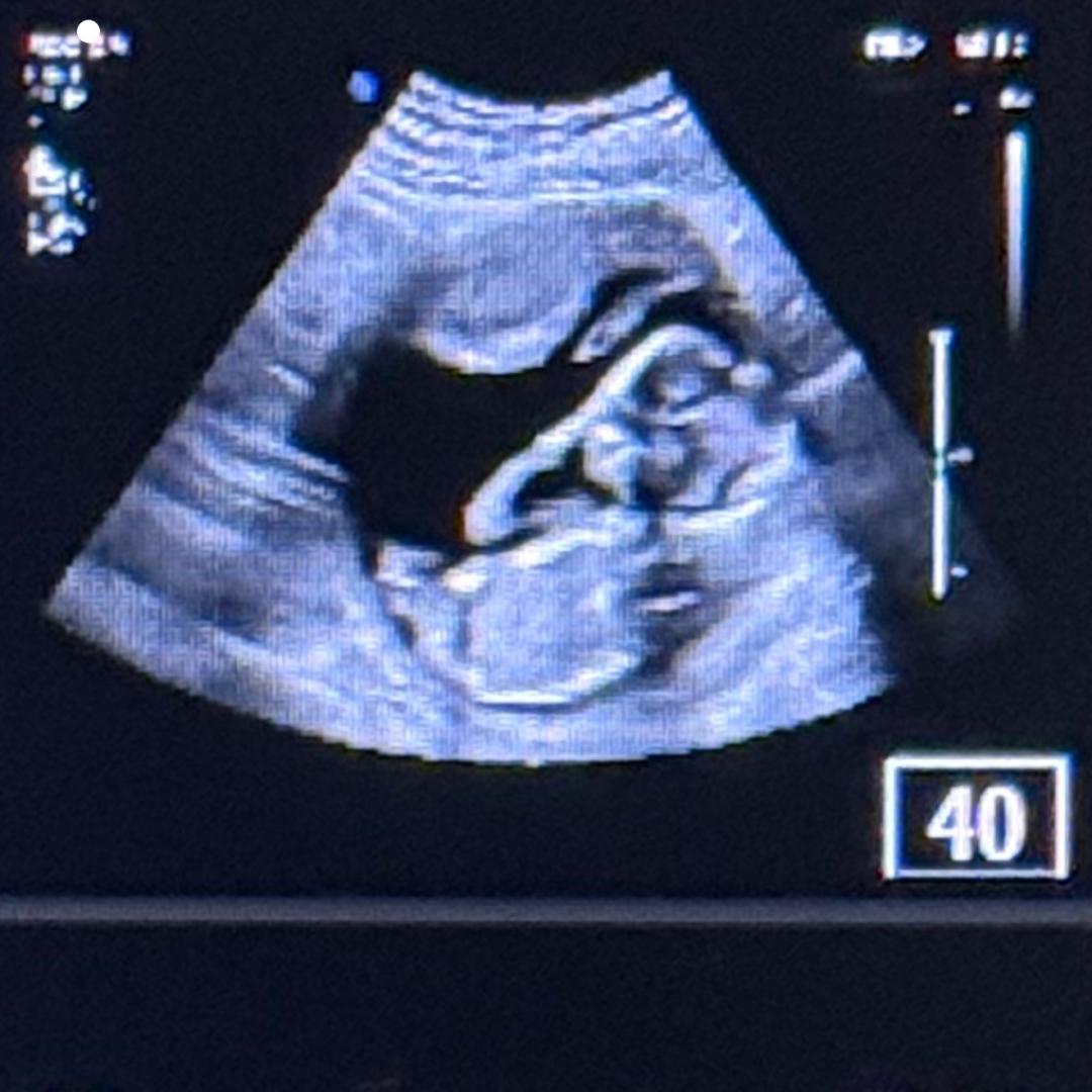 Photo shared by Cianca for their Babylist baby registry.