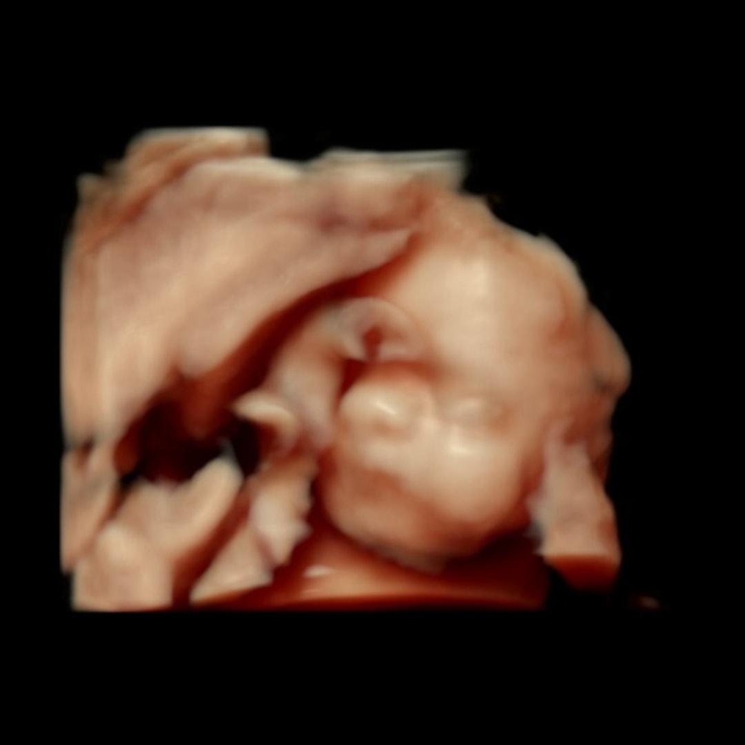 Photo shared by Ashlyn for their Babylist baby registry.