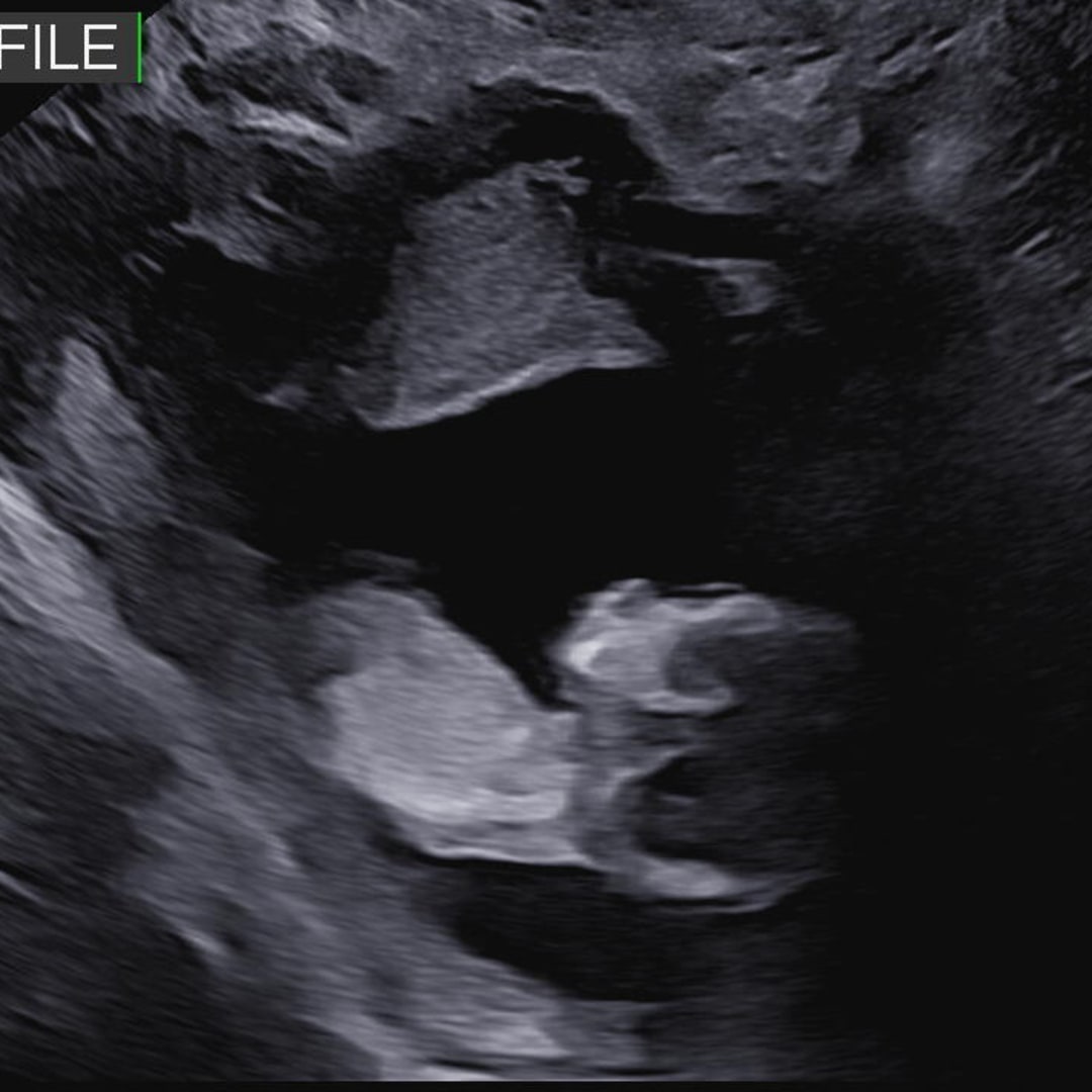 Photo shared by Adair for their Babylist baby registry.