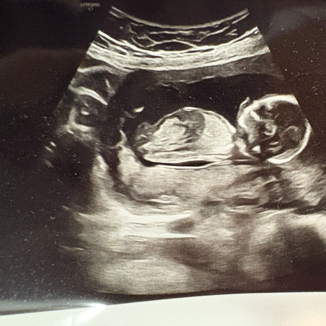 Photo shared by Mariah for their Babylist baby registry.