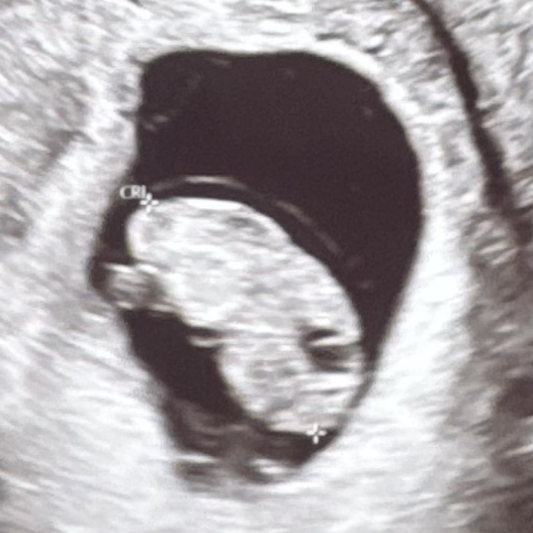 Photo shared by Elizabeth for their Babylist baby registry.