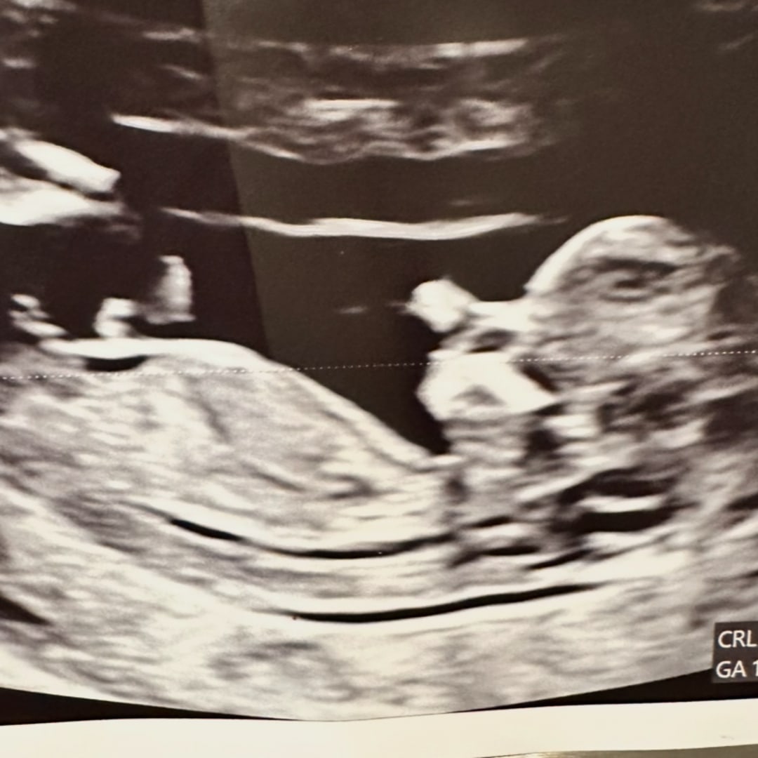 Photo shared by Laura for their Babylist baby registry.