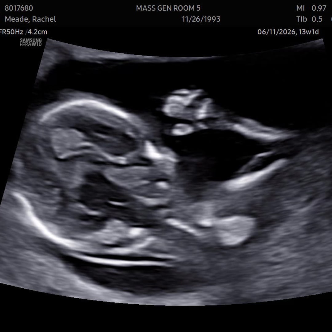 Photo shared by Rachel for their Babylist baby registry.