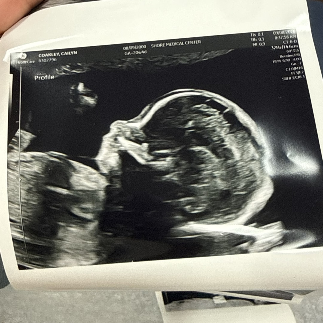 Photo shared by Cailyn for their Babylist baby registry.