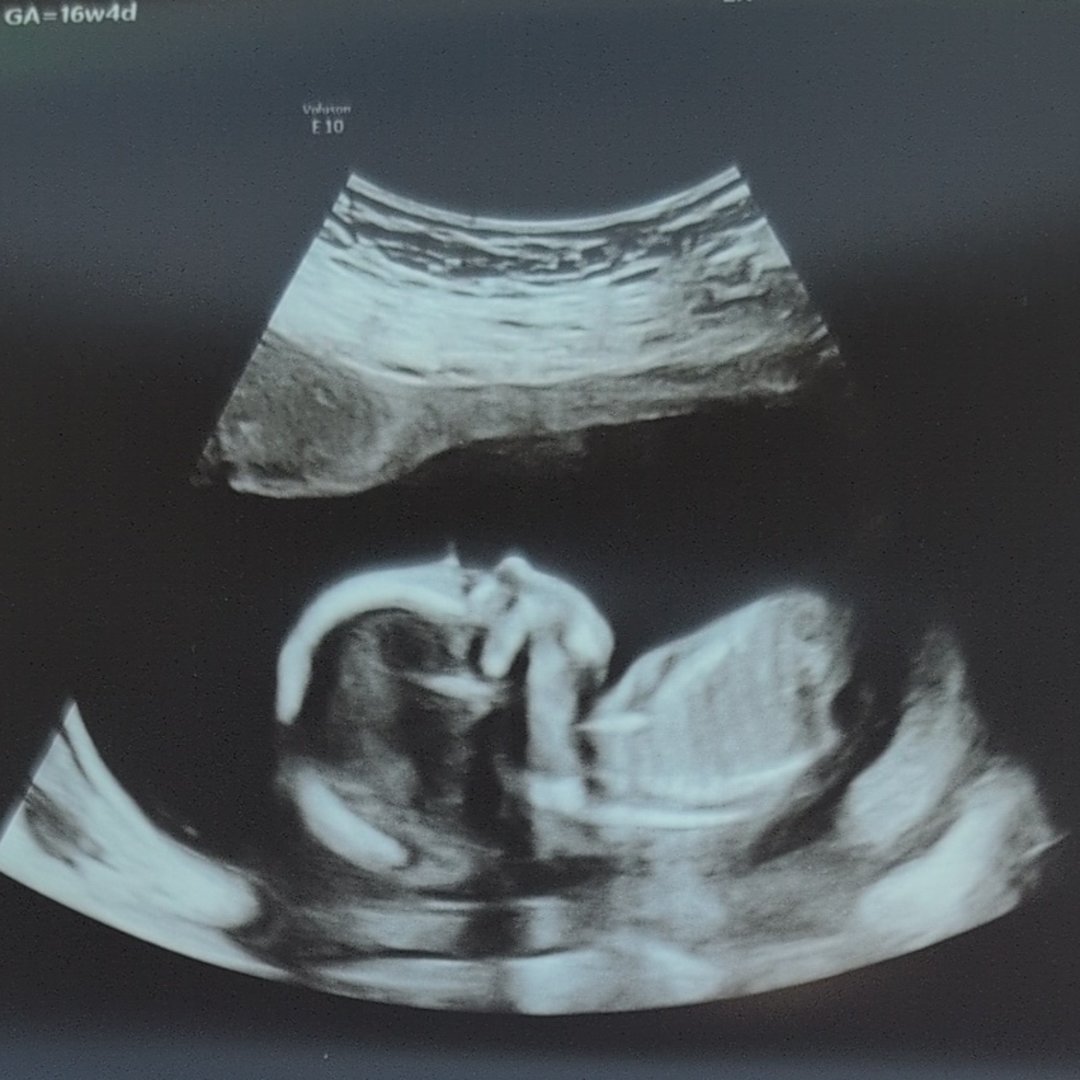 Photo shared by Ashley for their Babylist baby registry.