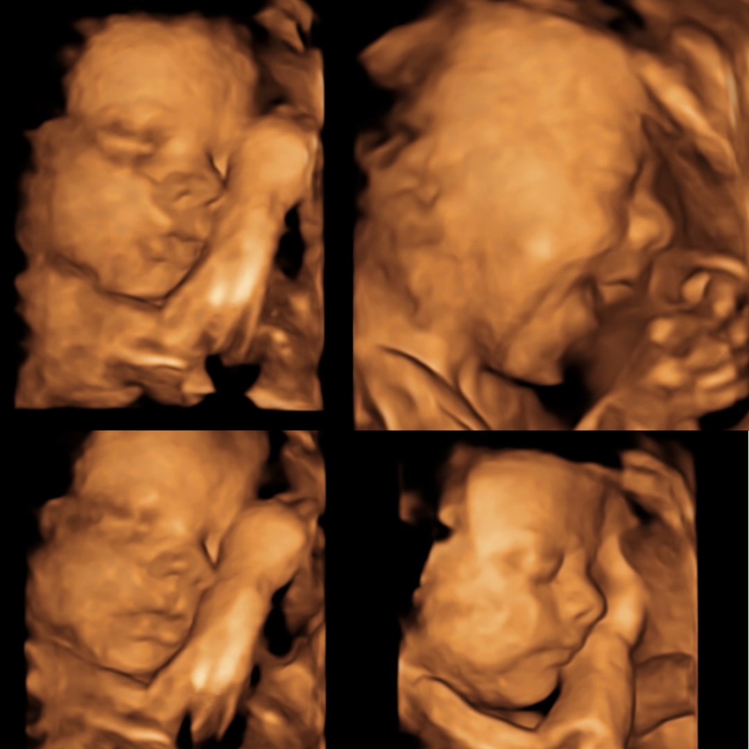 Photo shared by Corinne for their Babylist baby registry.