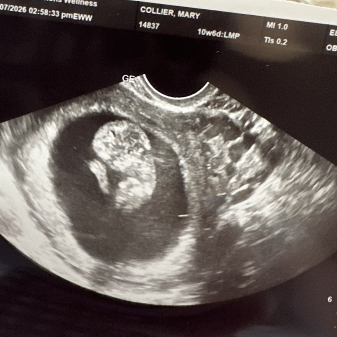 Photo shared by Mary for their Babylist baby registry.