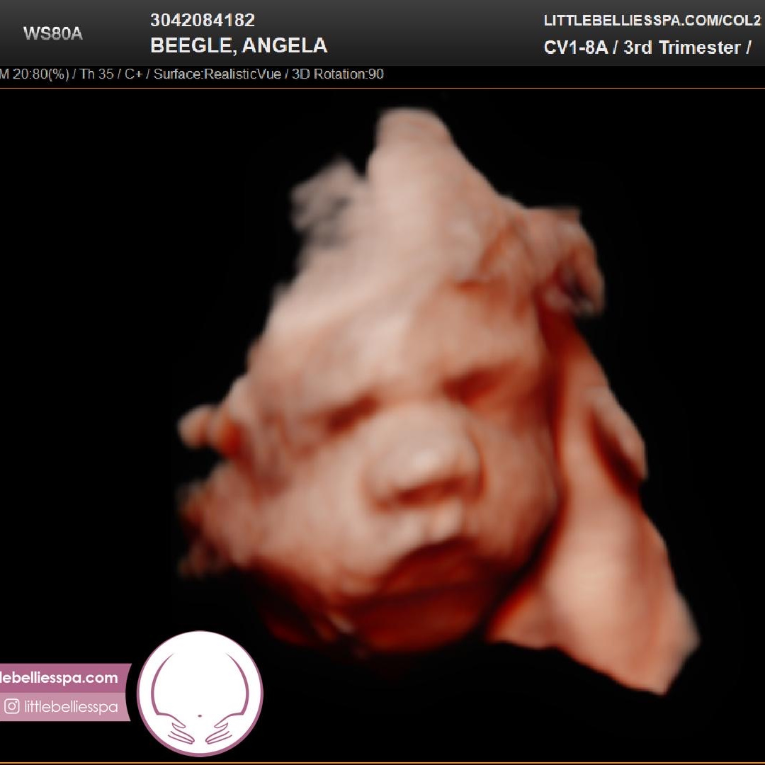 Photo shared by Angela for their Babylist baby registry.
