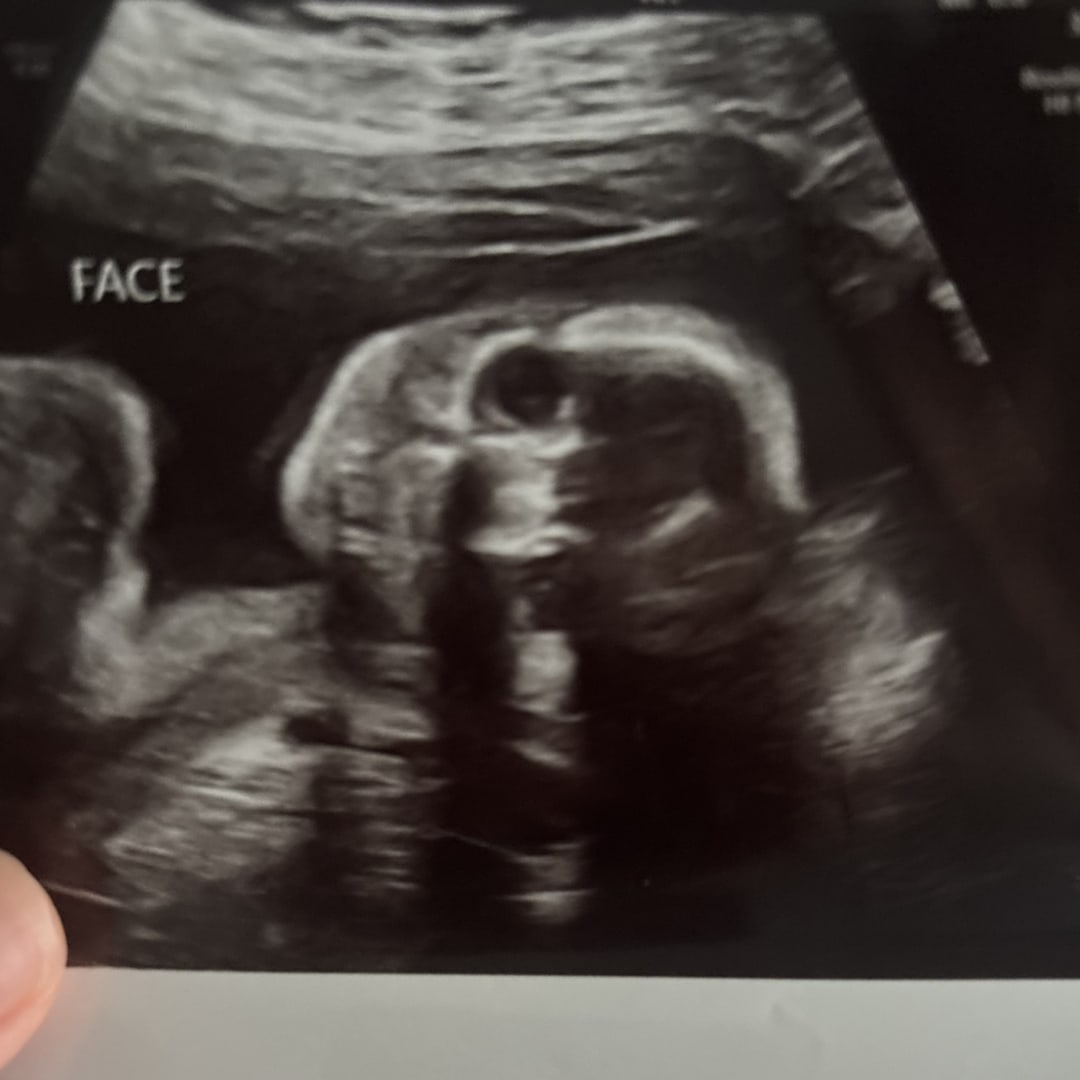 Photo shared by Jimena for their Babylist baby registry.