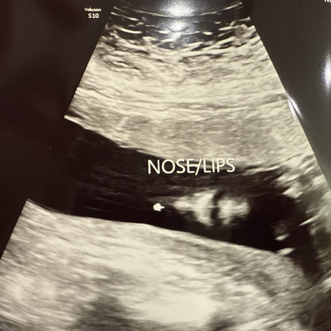 Photo shared by Bailey for their Babylist baby registry.