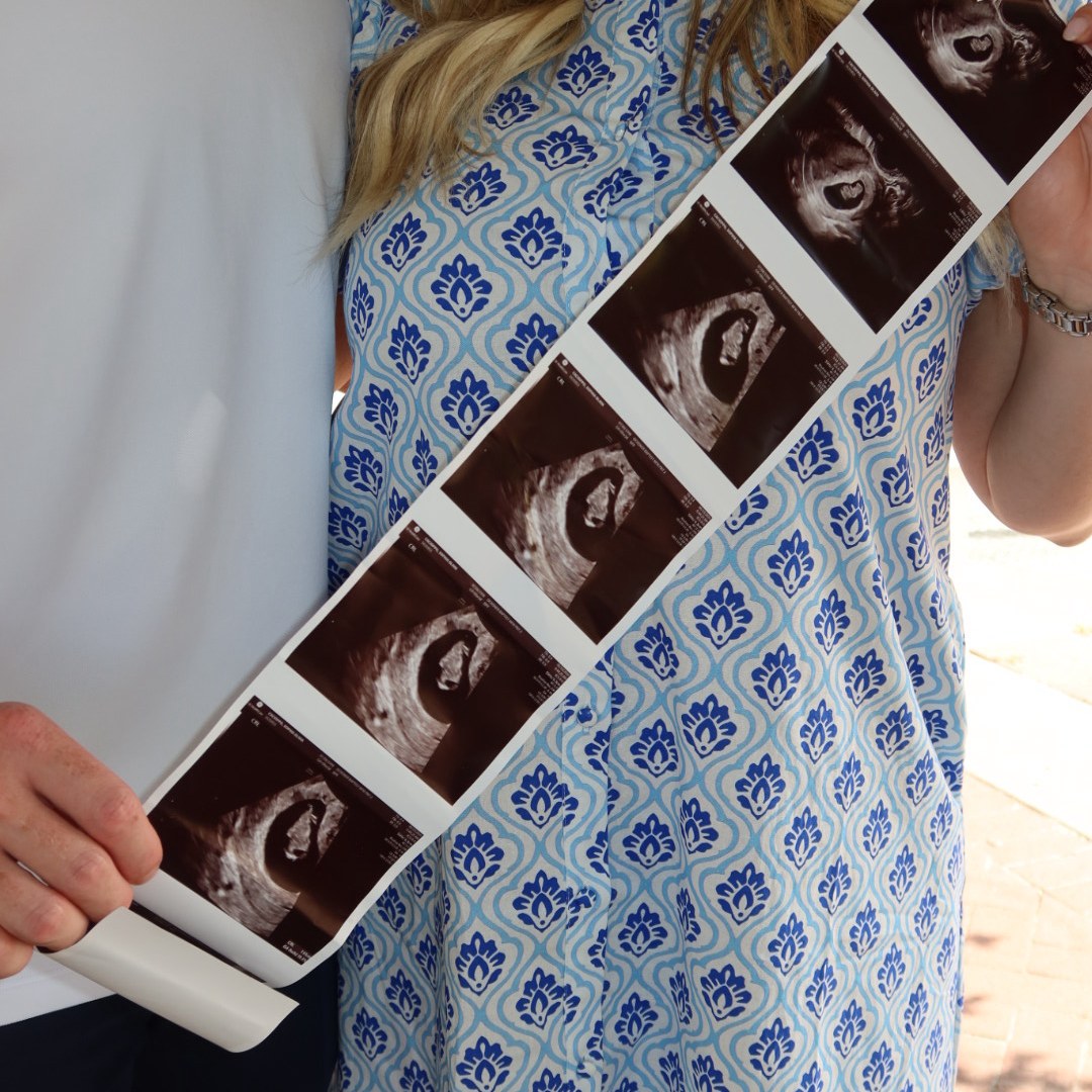 Photo shared by Sophia for their Babylist baby registry.