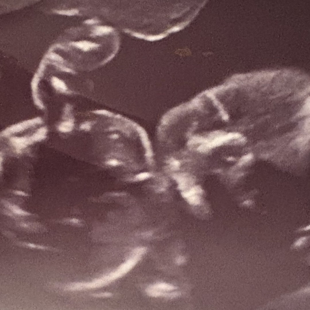 Photo shared by Grace for their Babylist baby registry.