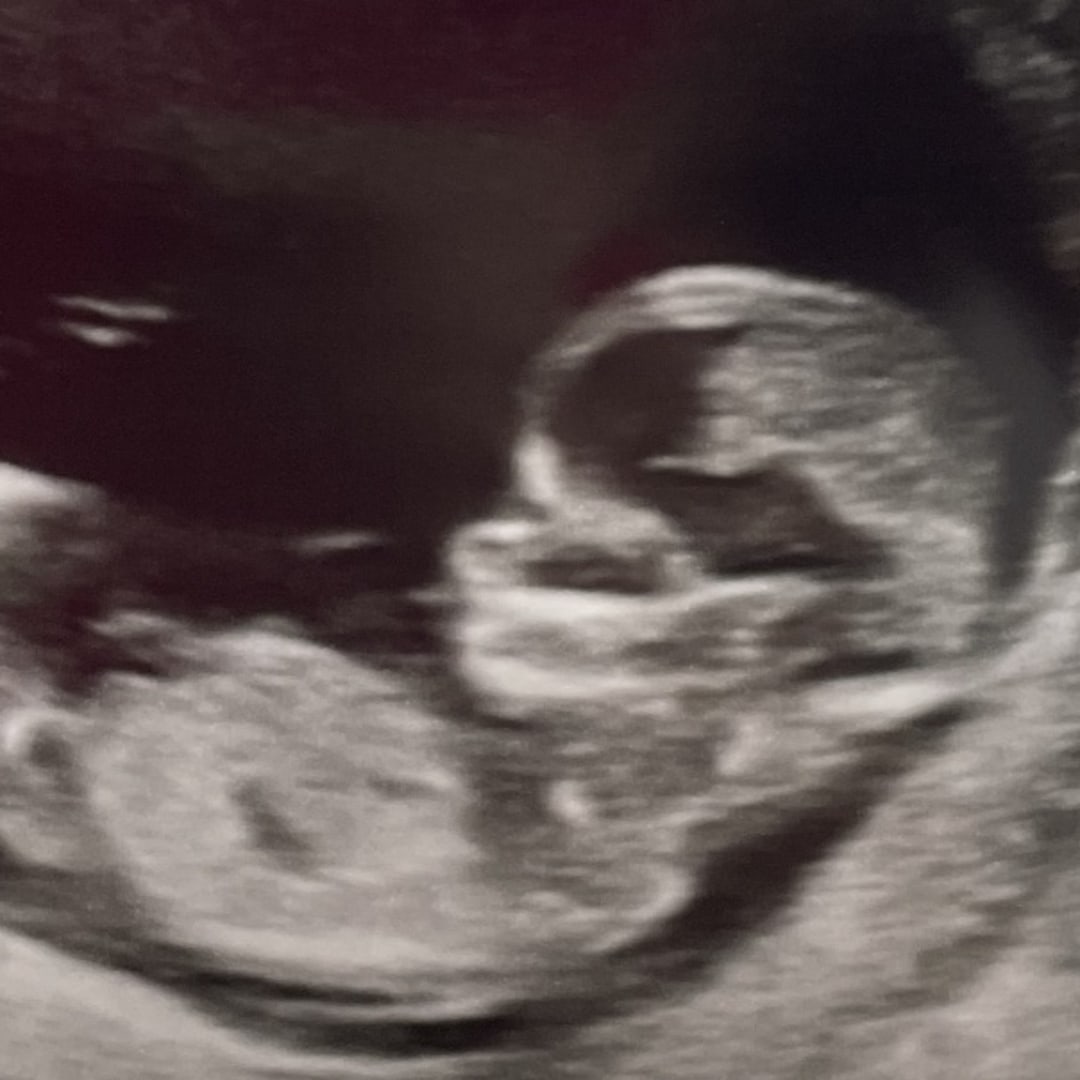 Photo shared by Christine for their Babylist baby registry.