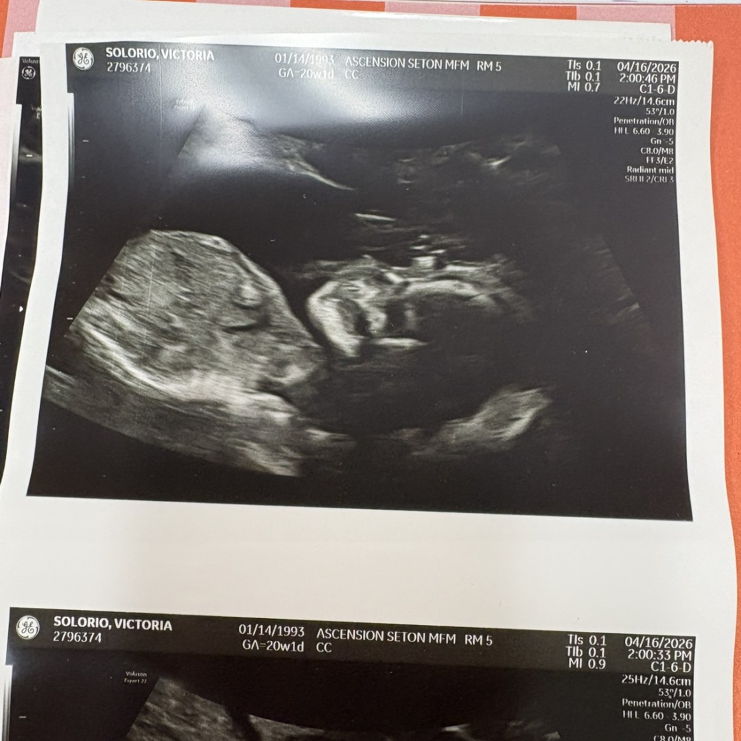 Photo shared by Victoria for their Babylist baby registry.