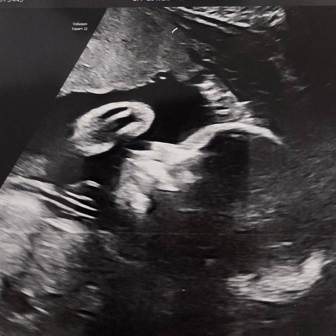 Photo shared by Jennifer for their Babylist baby registry.