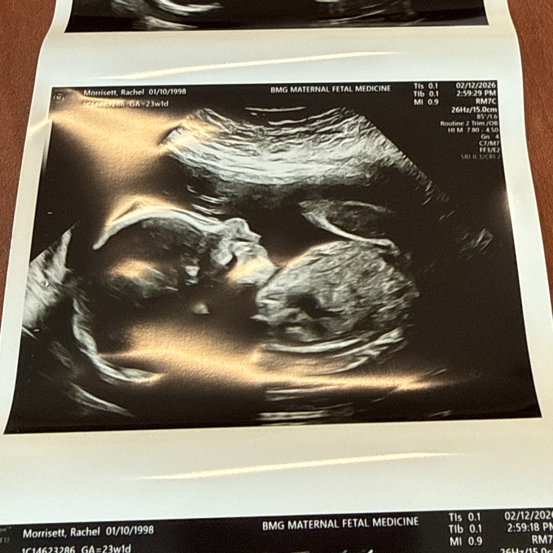 Photo shared by Rachel for their Babylist baby registry.