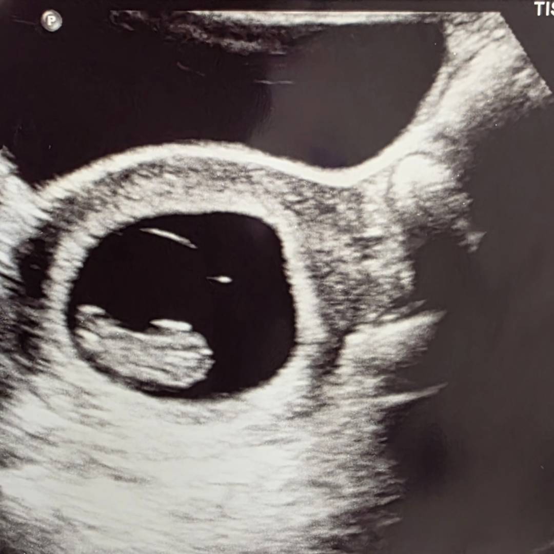 Photo shared by Chanel for their Babylist baby registry.