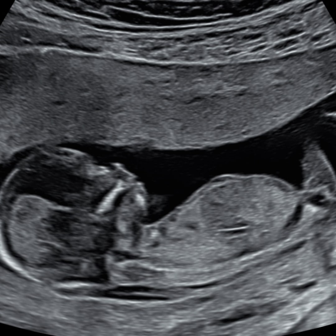Photo shared by Victoria for their Babylist baby registry.