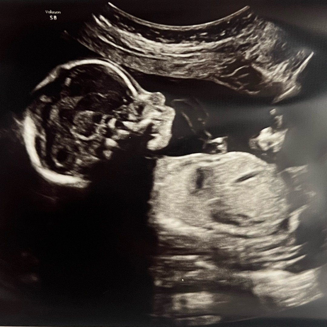 Photo shared by Hailey-Millicent for their Babylist baby registry.
