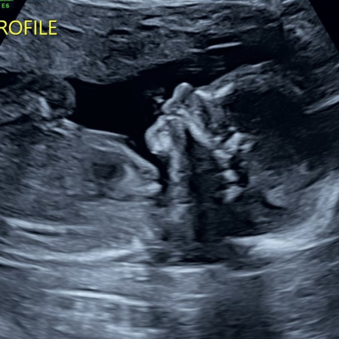 Photo shared by Ashley for their Babylist baby registry.