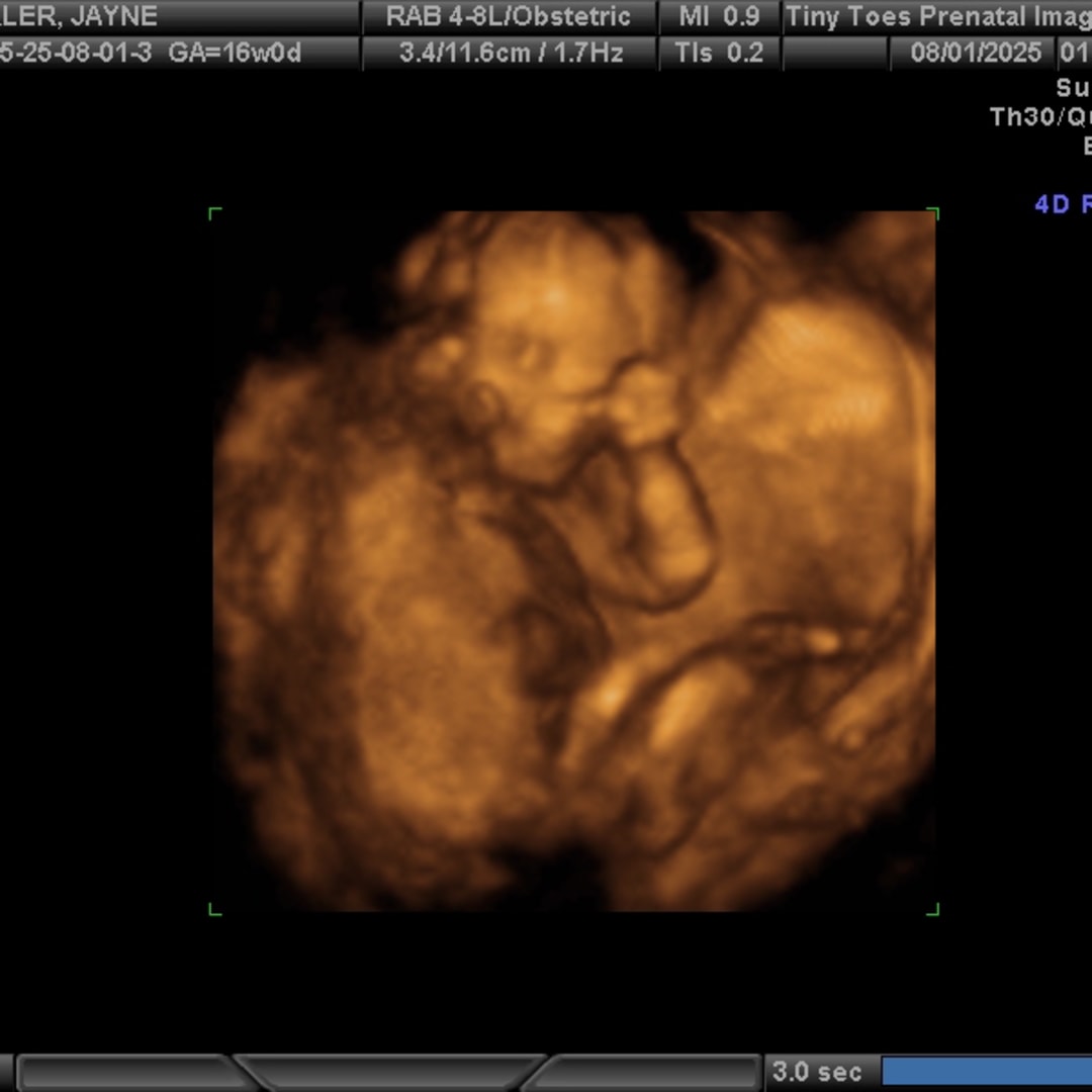 Photo shared by Jayne for their Babylist baby registry.