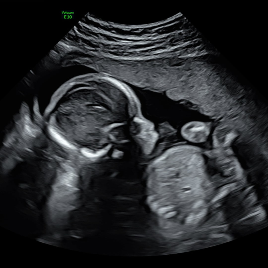 Photo shared by Sky for their Babylist baby registry.
