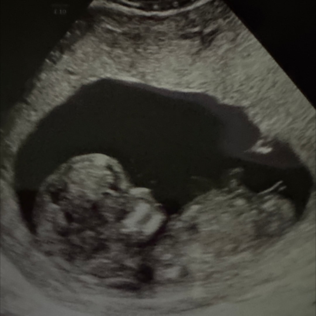 Photo shared by Veronica for their Babylist baby registry.