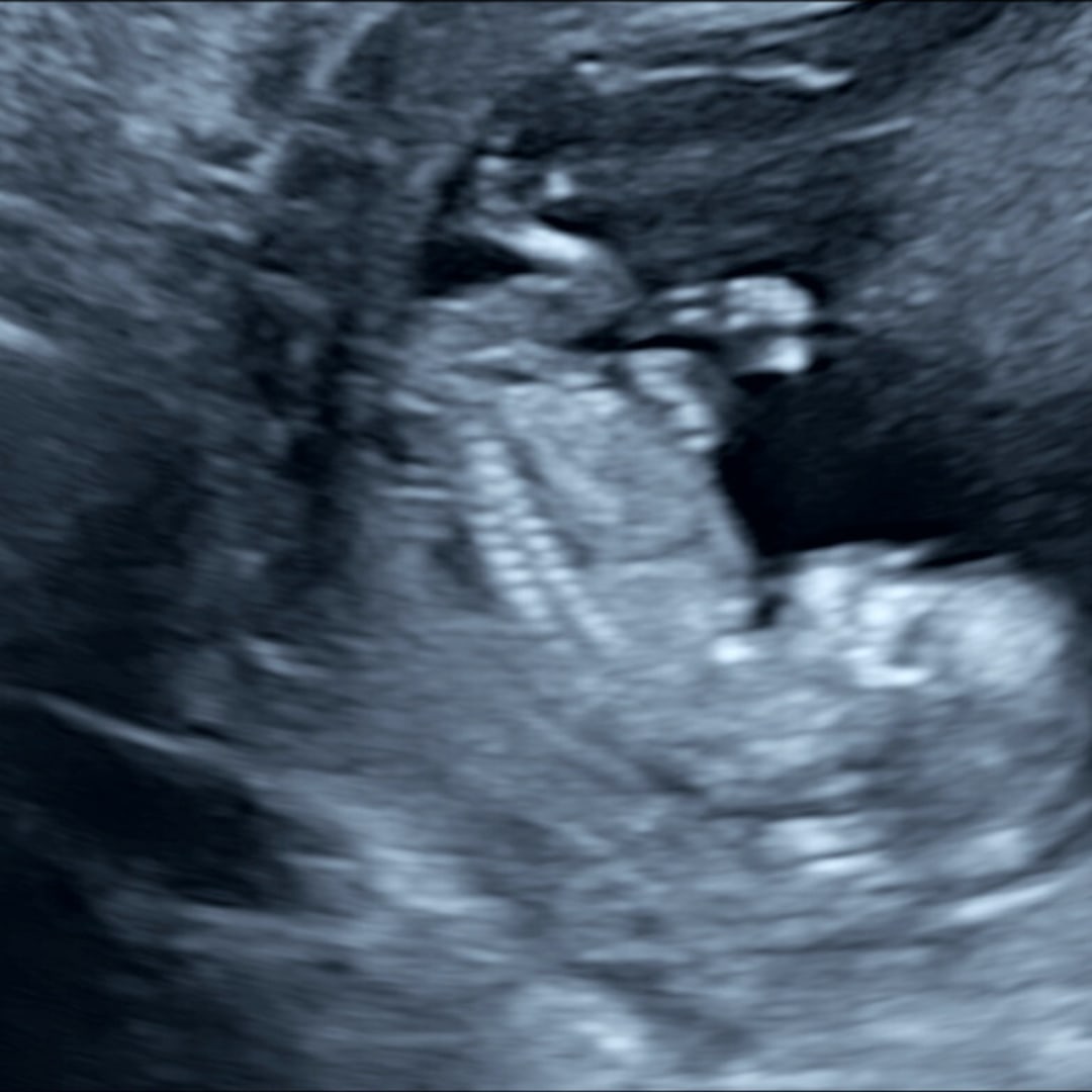 Photo shared by Zailly for their Babylist baby registry.