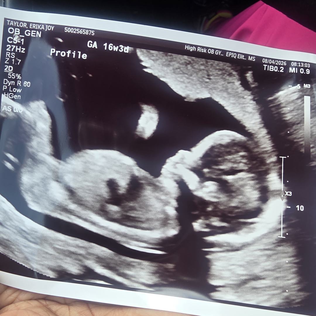 Photo shared by Erika for their Babylist baby registry.