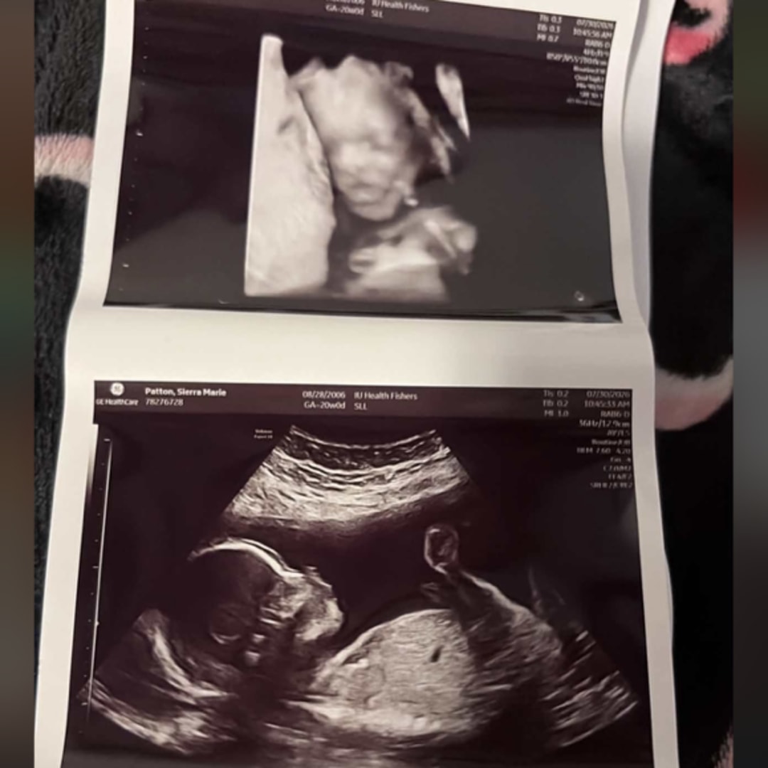 Photo shared by Sierra for their Babylist baby registry.