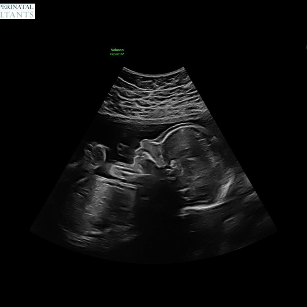Photo shared by Amy for their Babylist baby registry.