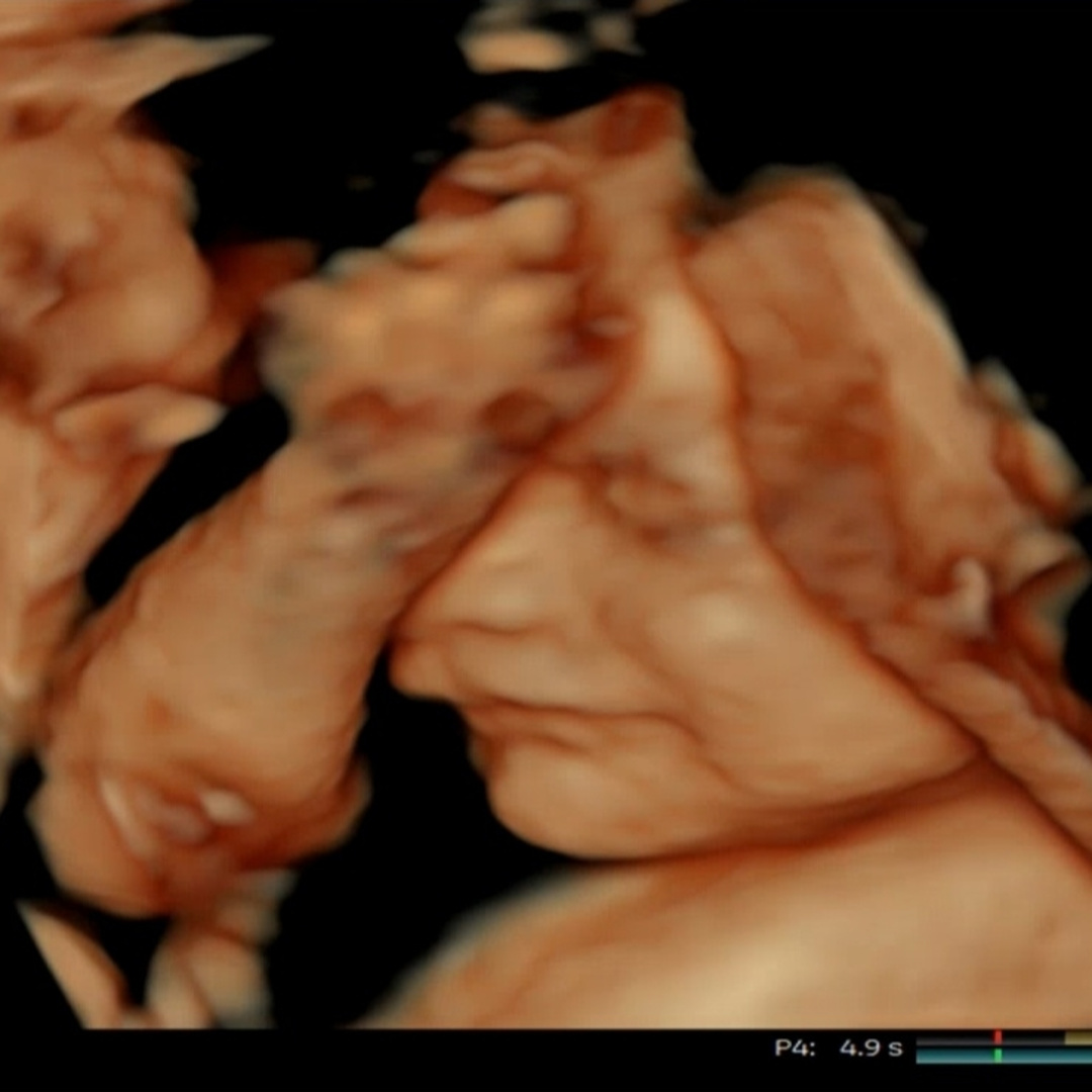 Photo shared by Kimberly for their Babylist baby registry.