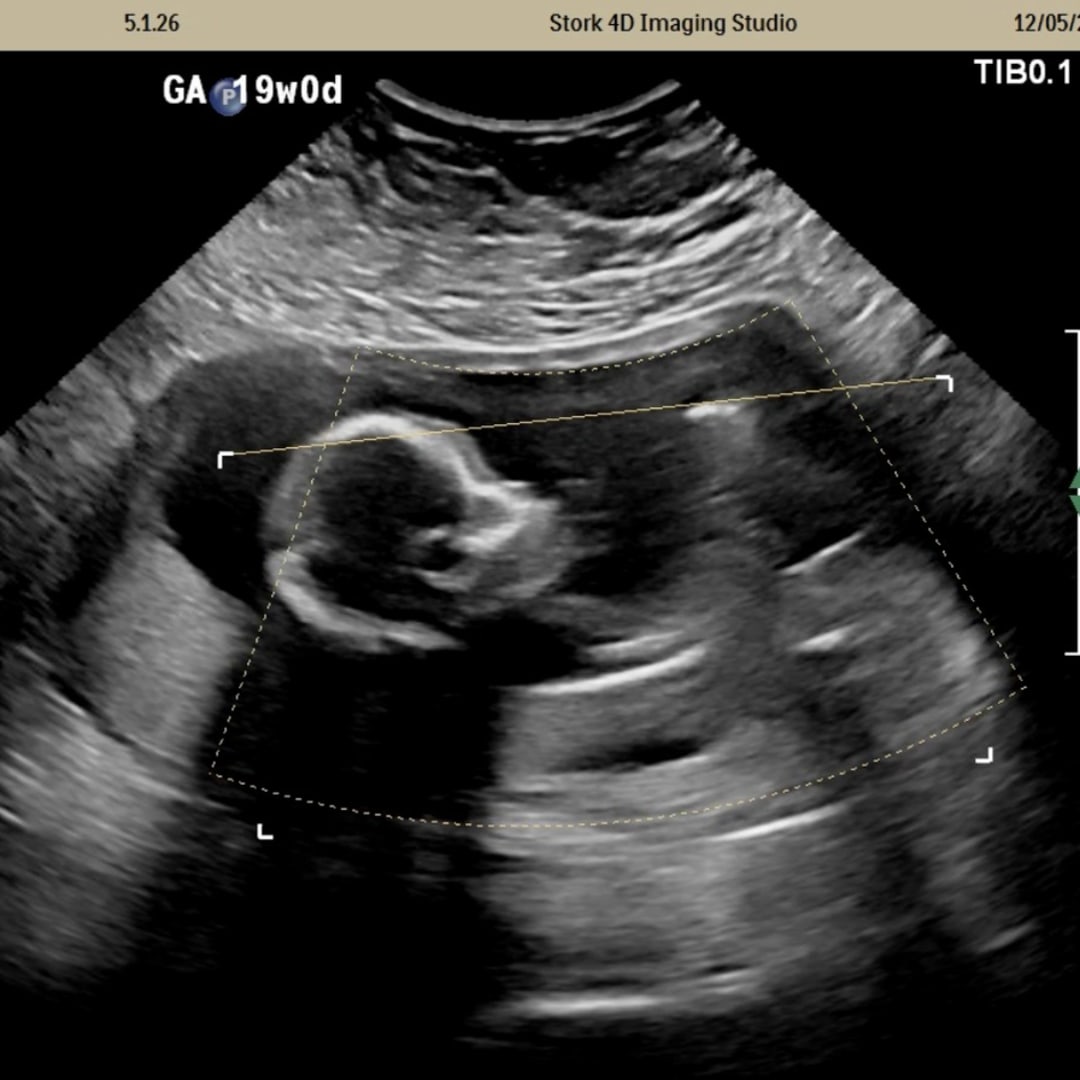 Photo shared by Tea for their Babylist baby registry.