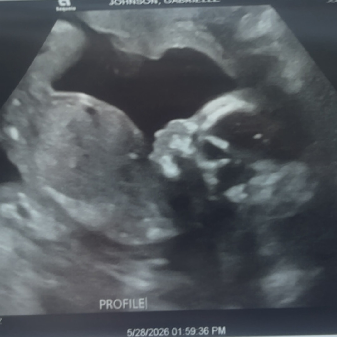 Photo shared by Gabrielle for their Babylist baby registry.