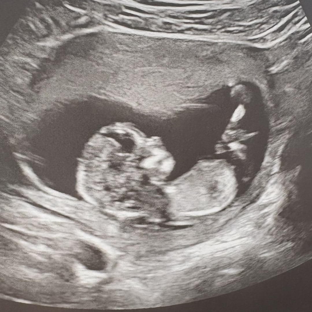 Photo shared by Paige for their Babylist baby registry.