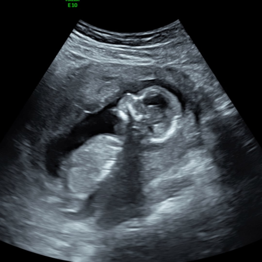 Photo shared by Krista for their Babylist baby registry.