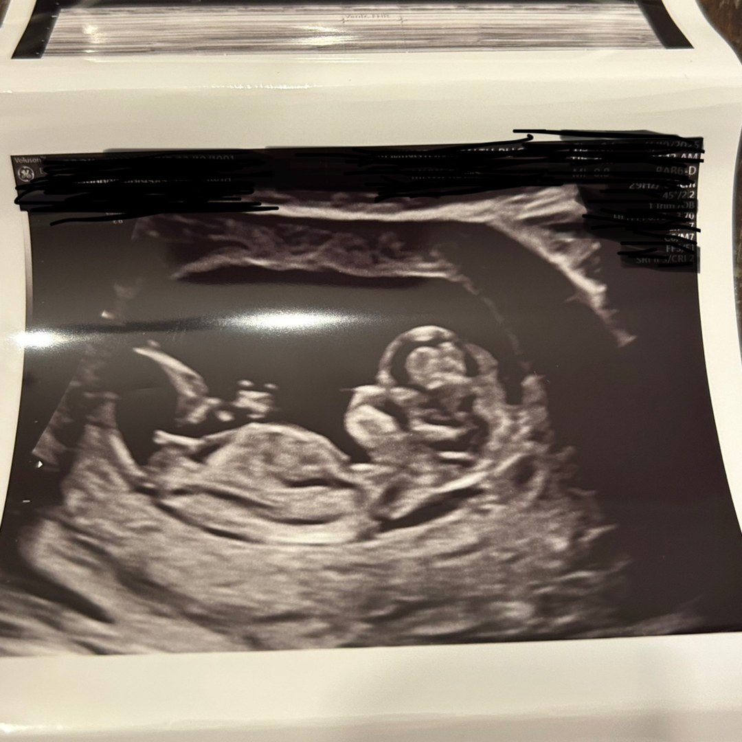 Photo shared by Gina for their Babylist baby registry.